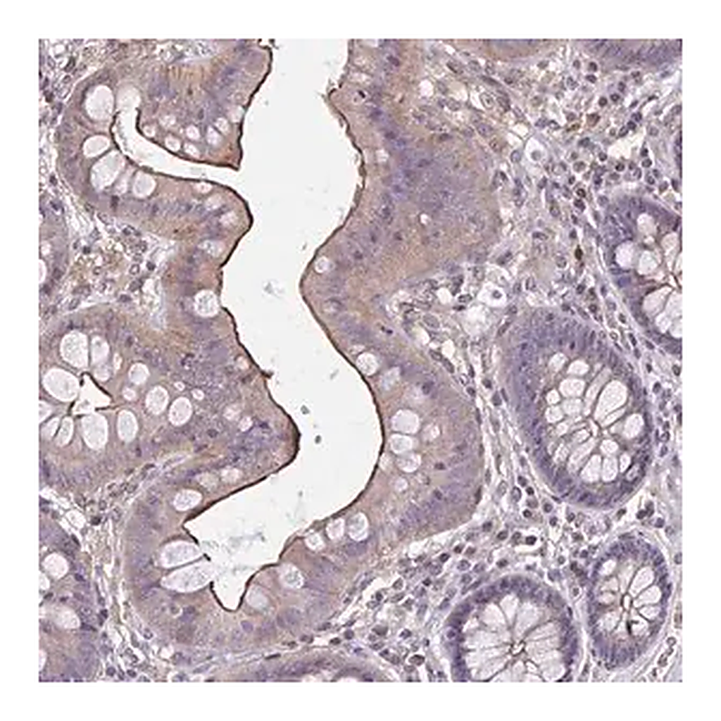Merck Anti-MMP14 antibody produced in rabbit