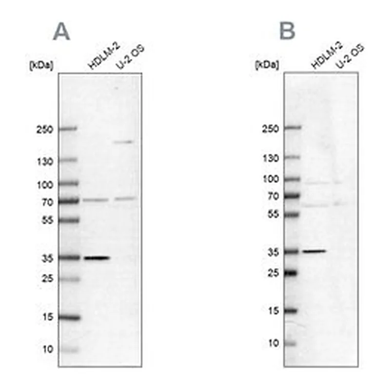 Merck Anti-TTC19 antibody produced in rabbit