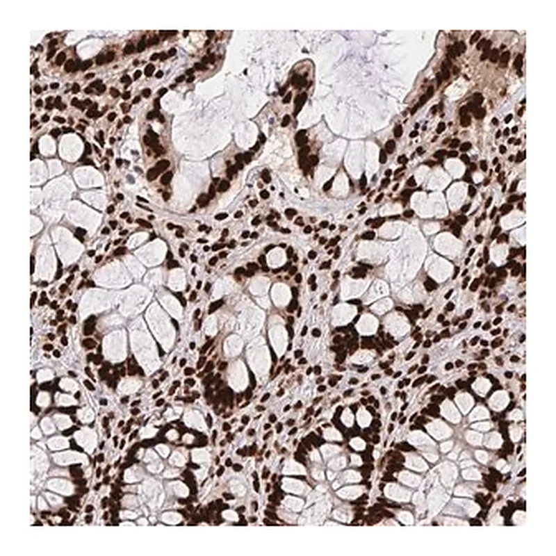 Merck Anti-HNRNPL antibody produced in rabbit