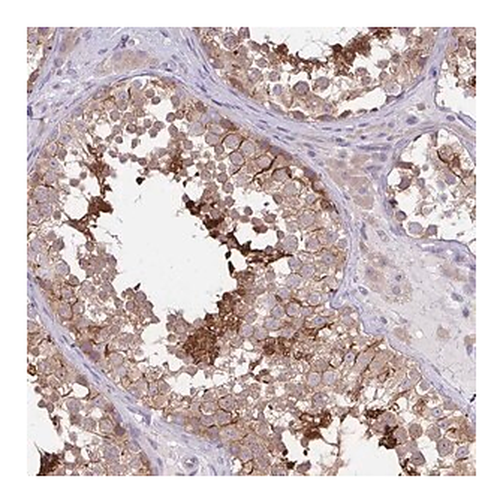Merck Anti-C17orf105 antibody produced in rabbit