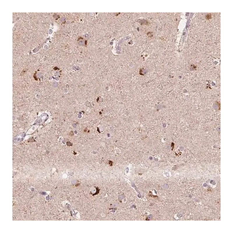 Merck Anti-METTL13 antibody produced in rabbit