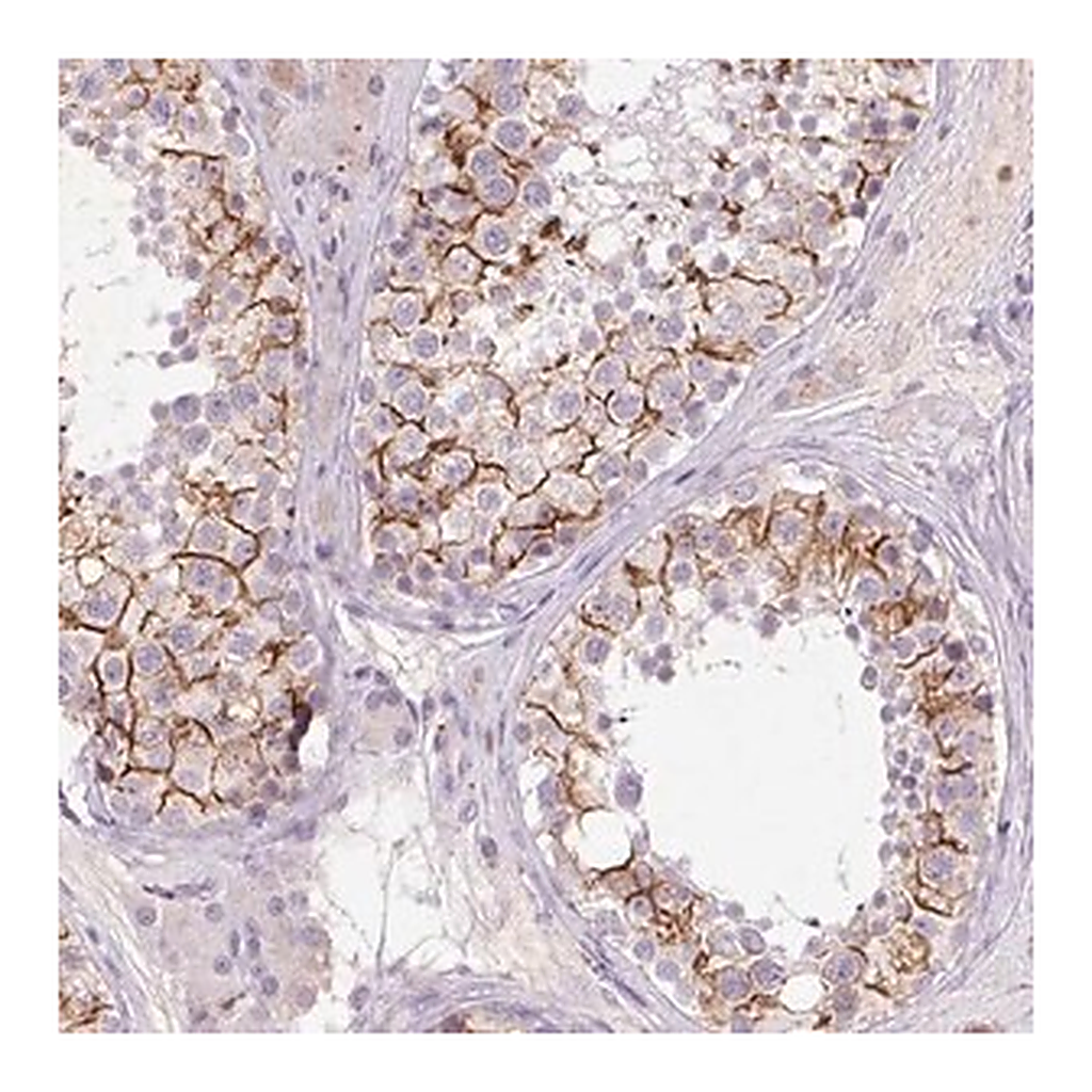 Merck Anti-FNDC7 antibody produced in rabbit