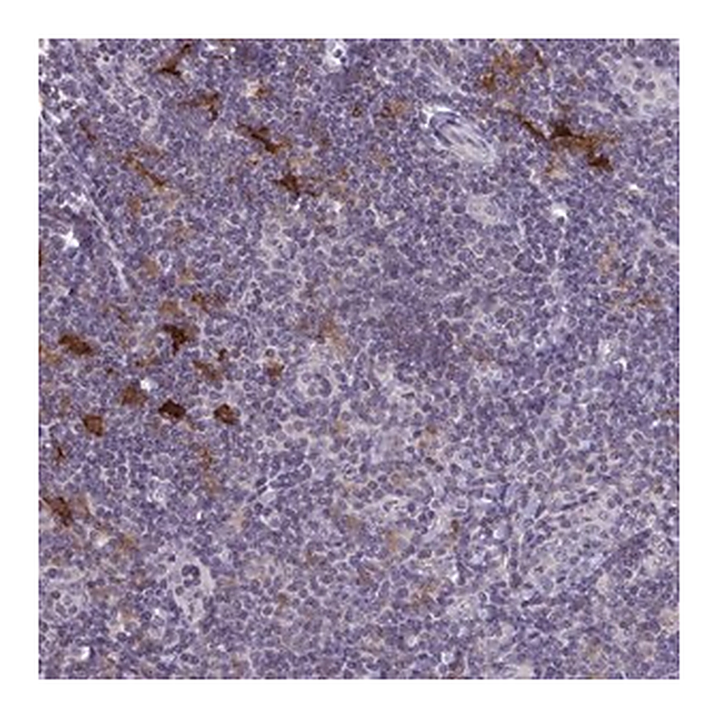 Merck Anti-SNX11 antibody produced in rabbit