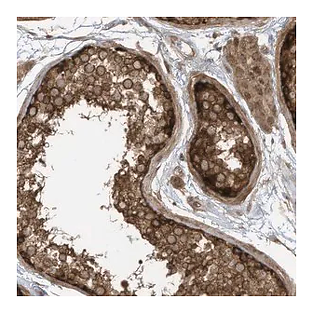 Merck Anti-REPS1 antibody produced in rabbit
