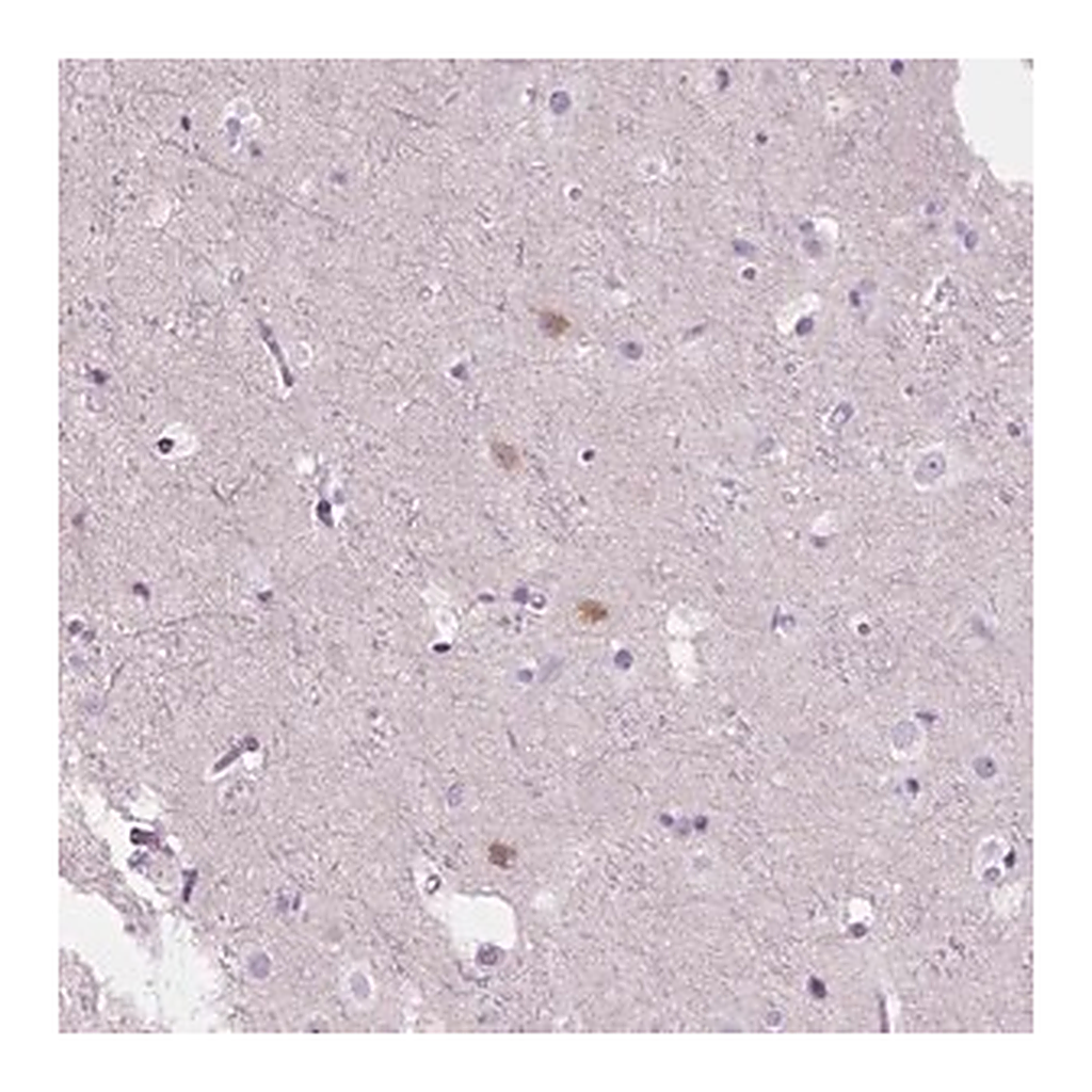 Merck Anti-NOS1AP antibody produced in rabbit