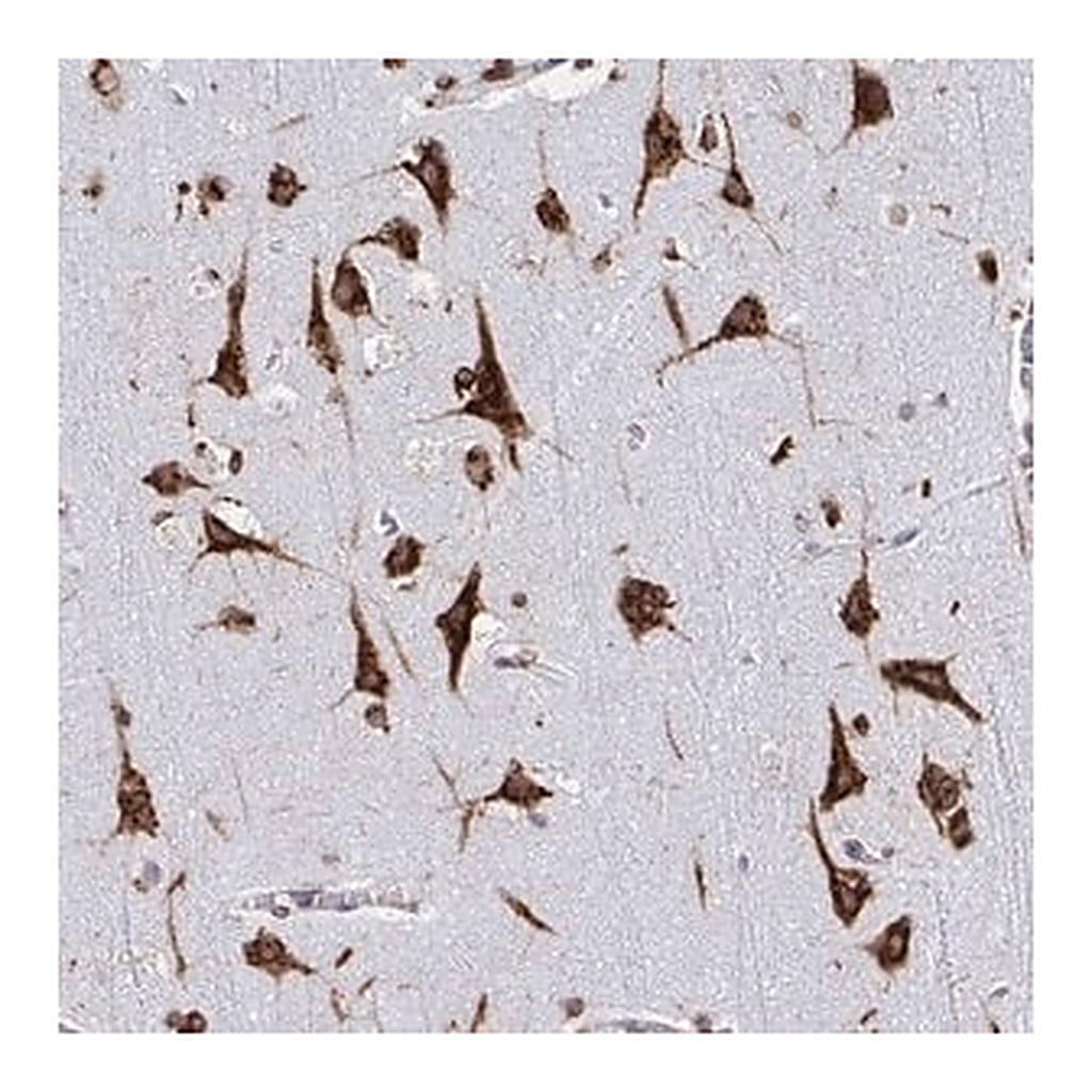 Merck Anti-RFK antibody produced in rabbit