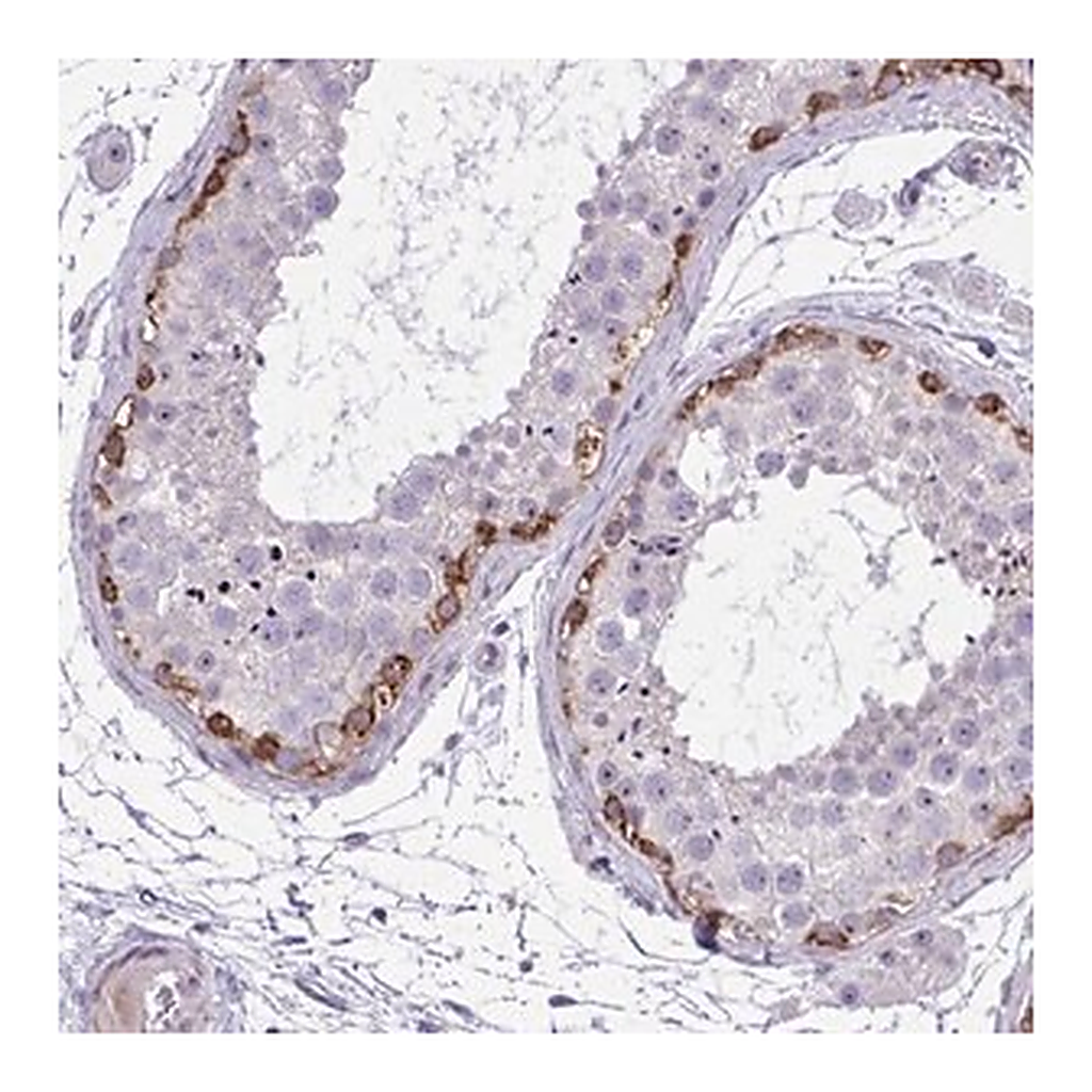 Merck Anti-GRK4 antibody produced in rabbit