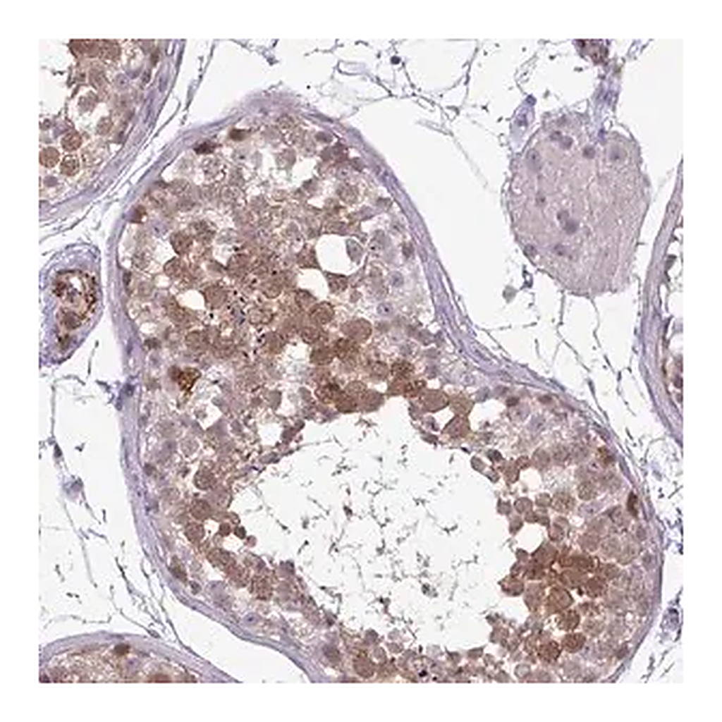 Merck Anti-UBE2S antibody produced in rabbit