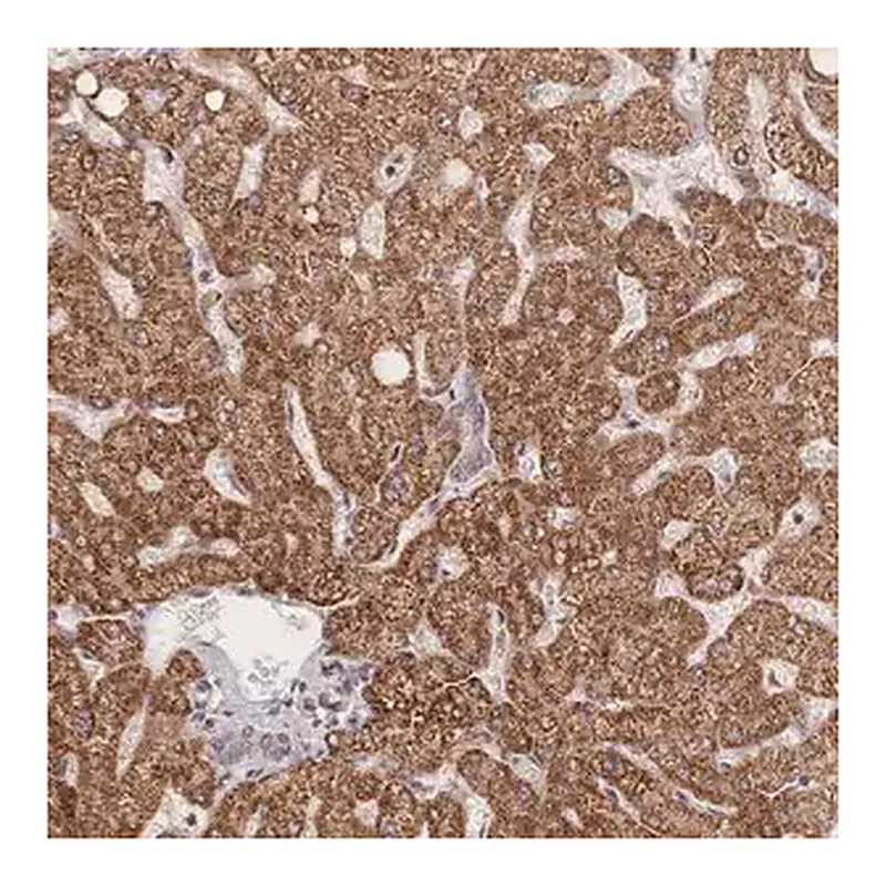 Merck Anti-LRP5 antibody produced in rabbit