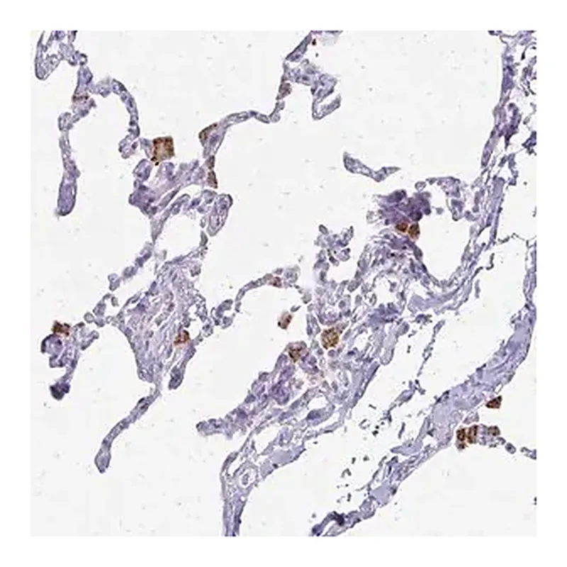 Merck Anti-ACP5 antibody produced in rabbit