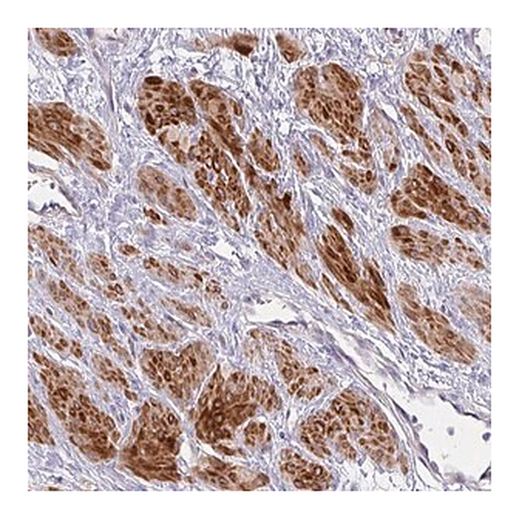 Merck Anti-MOCS1 antibody produced in rabbit