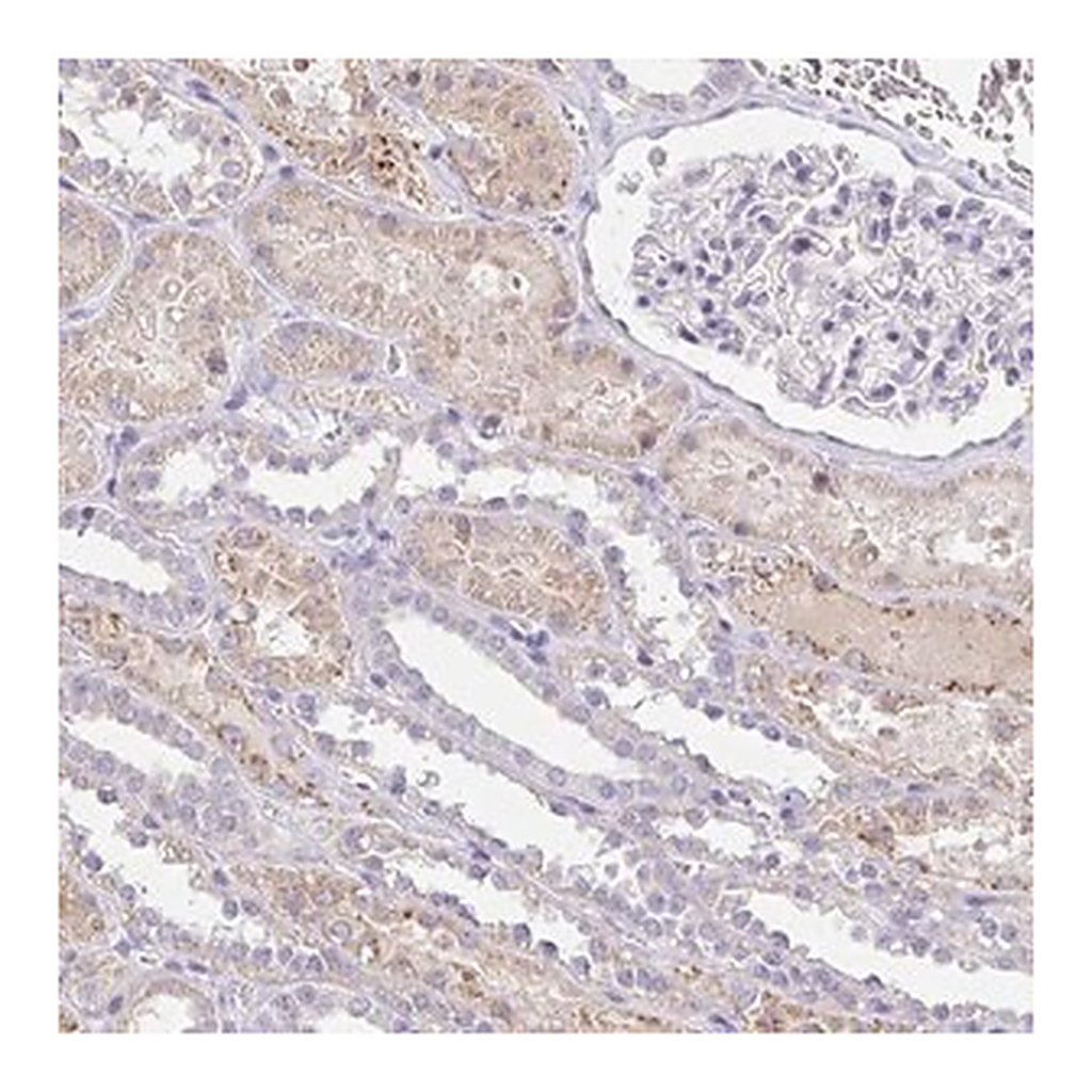 Merck Anti-PKN3 antibody produced in rabbit