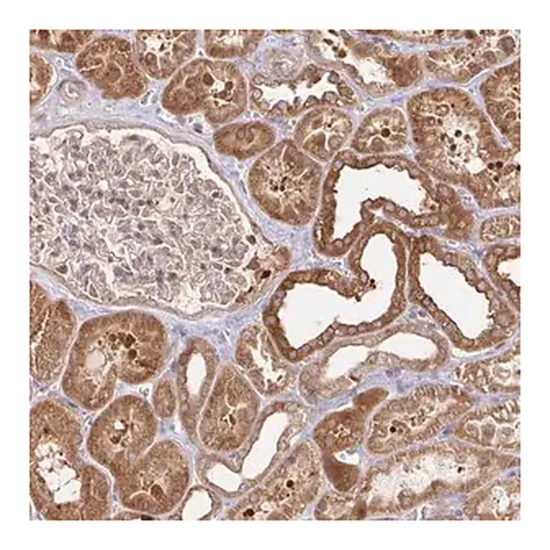 Merck Anti-AACS antibody produced in rabbit