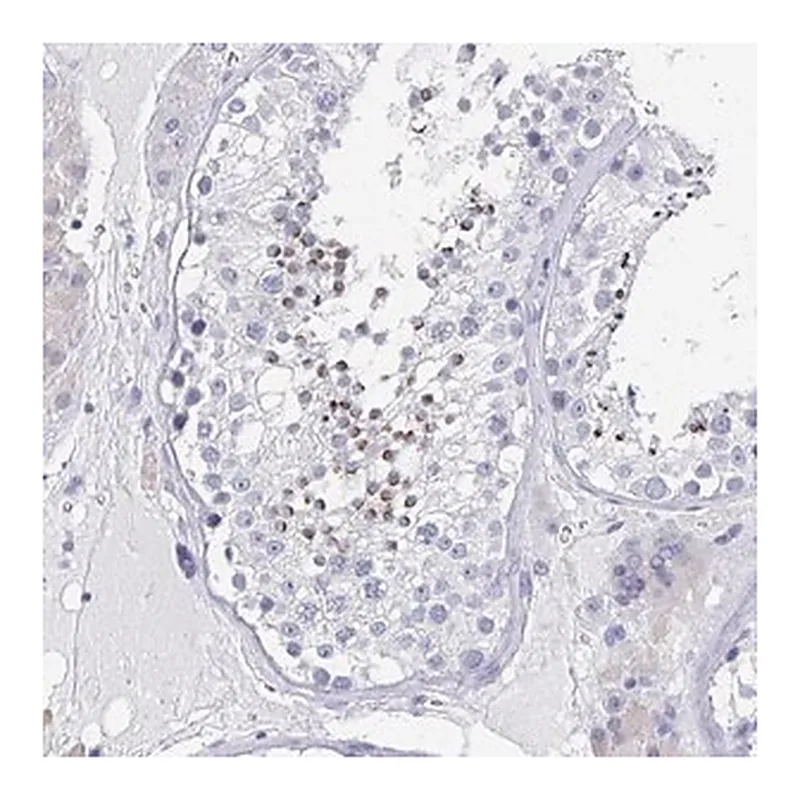 Merck Anti-TNFRSF8 antibody produced in rabbit