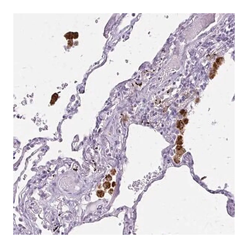Merck Anti-ACP5 antibody produced in rabbit