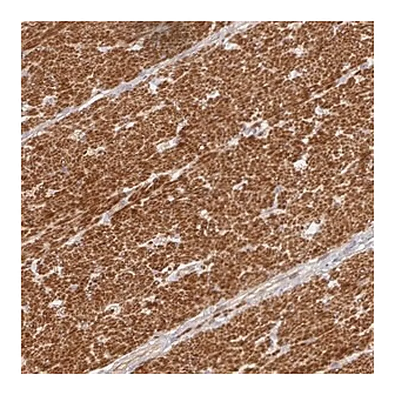 Merck Anti-METTL22 antibody produced in rabbit