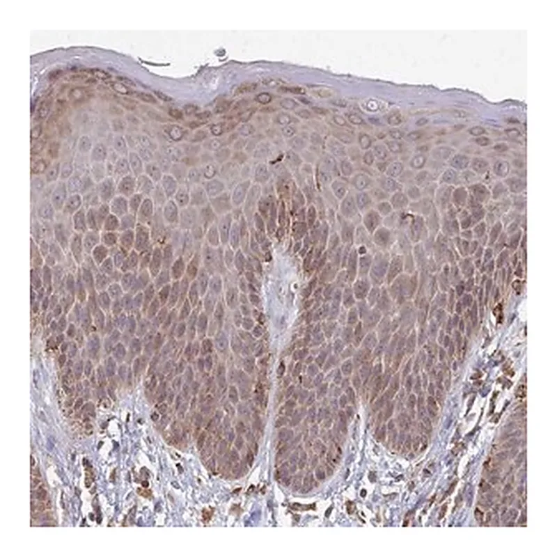 Merck Anti-PPP1R13L antibody produced in rabbit