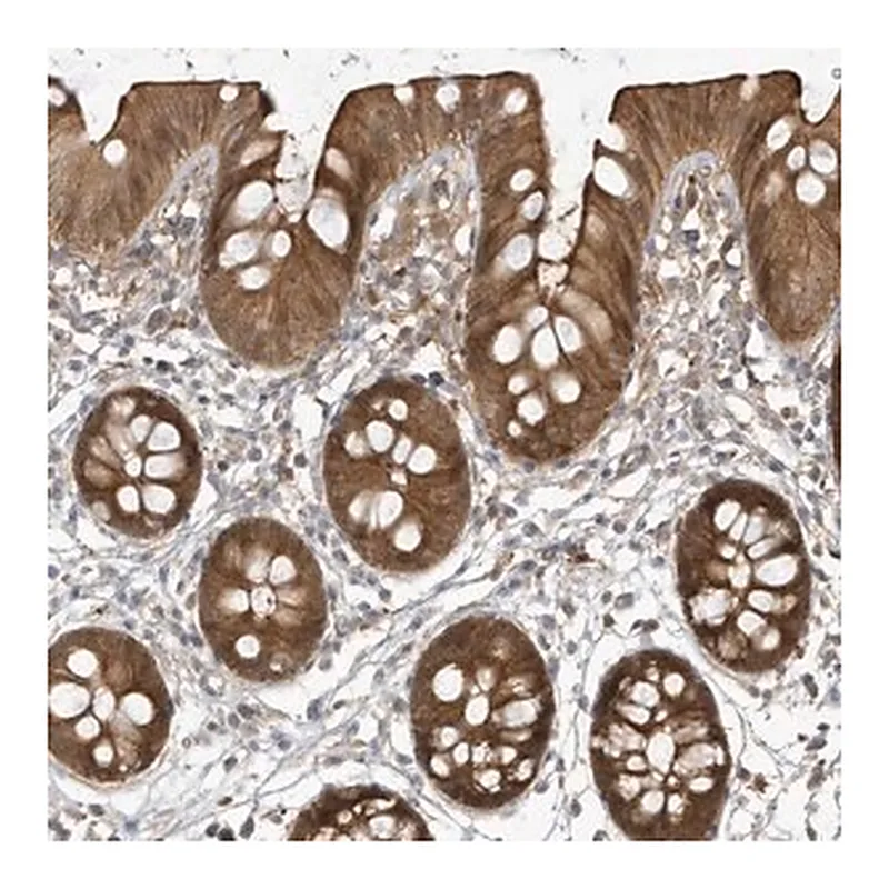 Merck Anti-HNMT antibody produced in rabbit