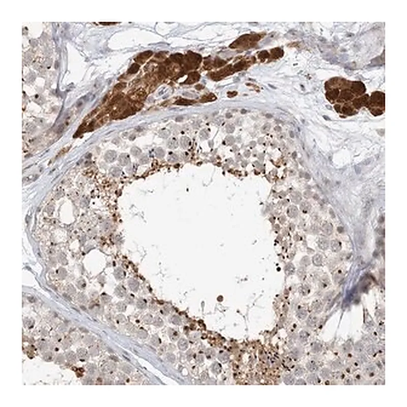 Merck Anti-ZCCHC4 antibody produced in rabbit