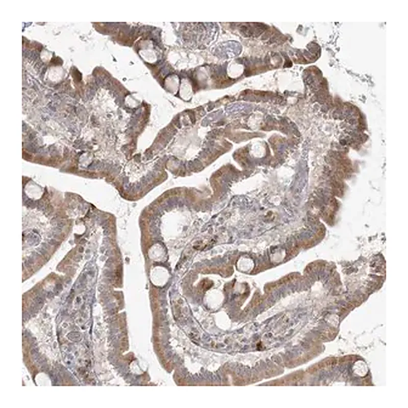 Merck Anti-HACL1 antibody produced in rabbit