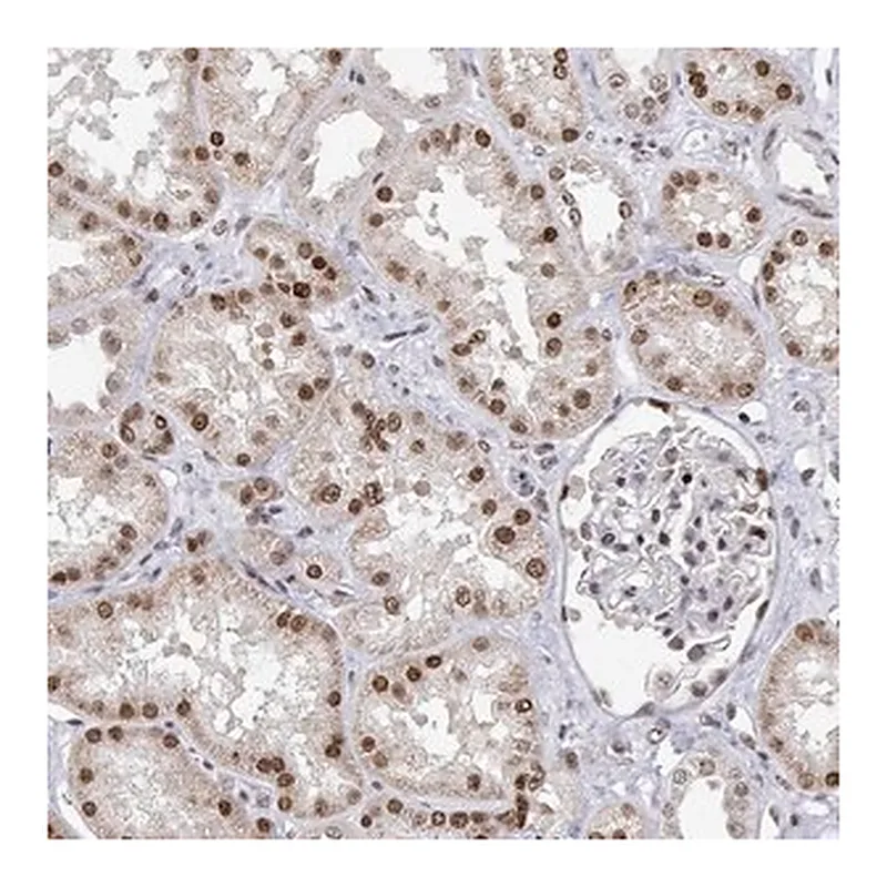 Merck Anti-XPC antibody produced in rabbit