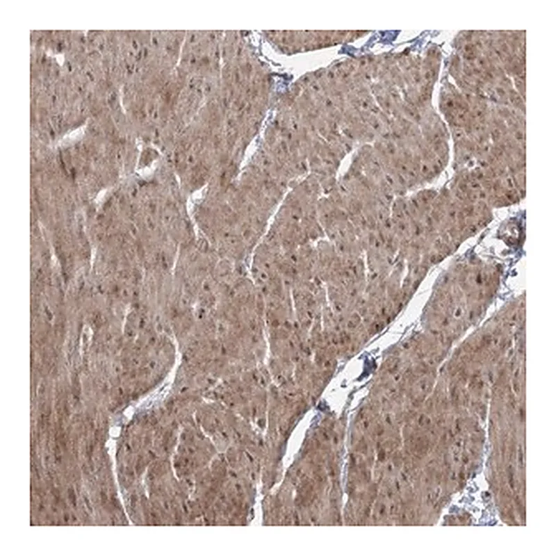Merck Anti-ZSCAN23 antibody produced in rabbit