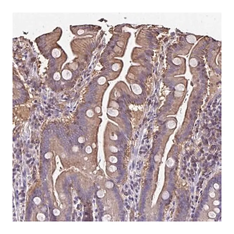 Merck Anti-RPRML antibody produced in rabbit
