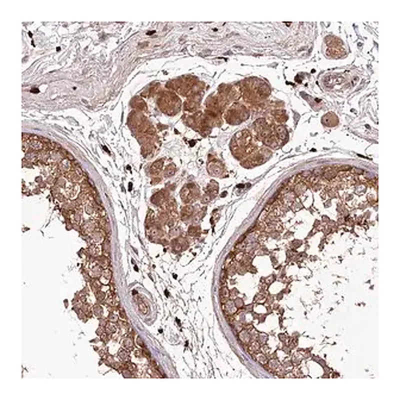 Merck Anti-PPP1R21 antibody produced in rabbit
