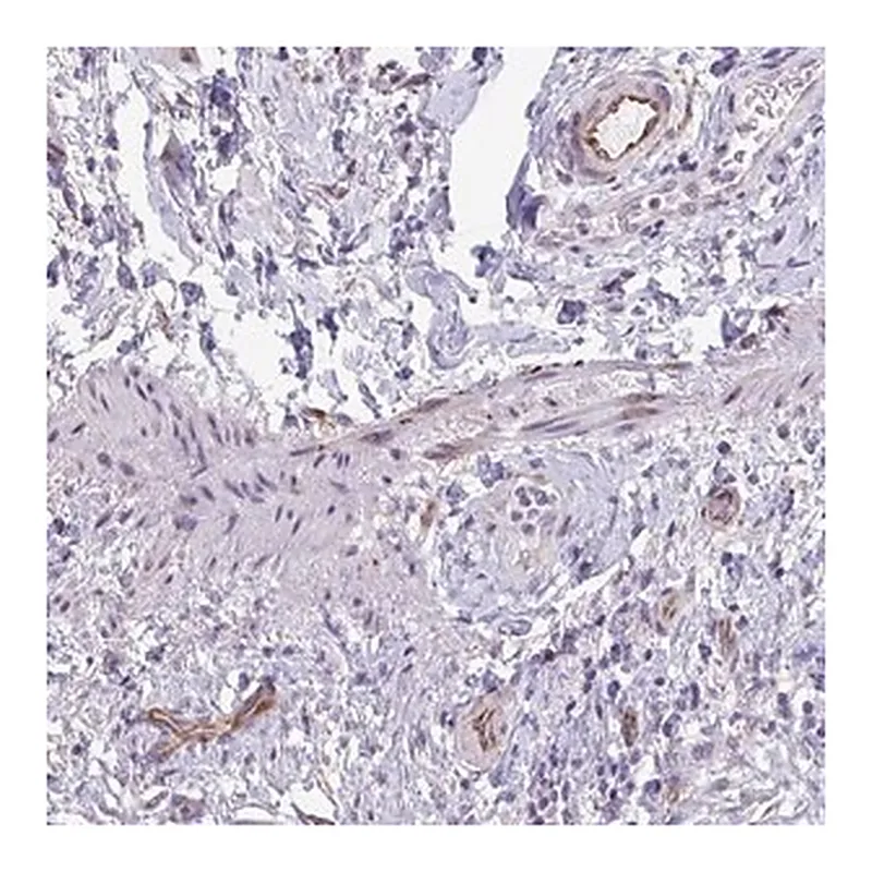 Merck Anti-C10orf10 antibody produced in rabbit