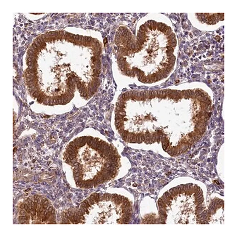 Merck Anti-PPIP5K2 antibody produced in rabbit
