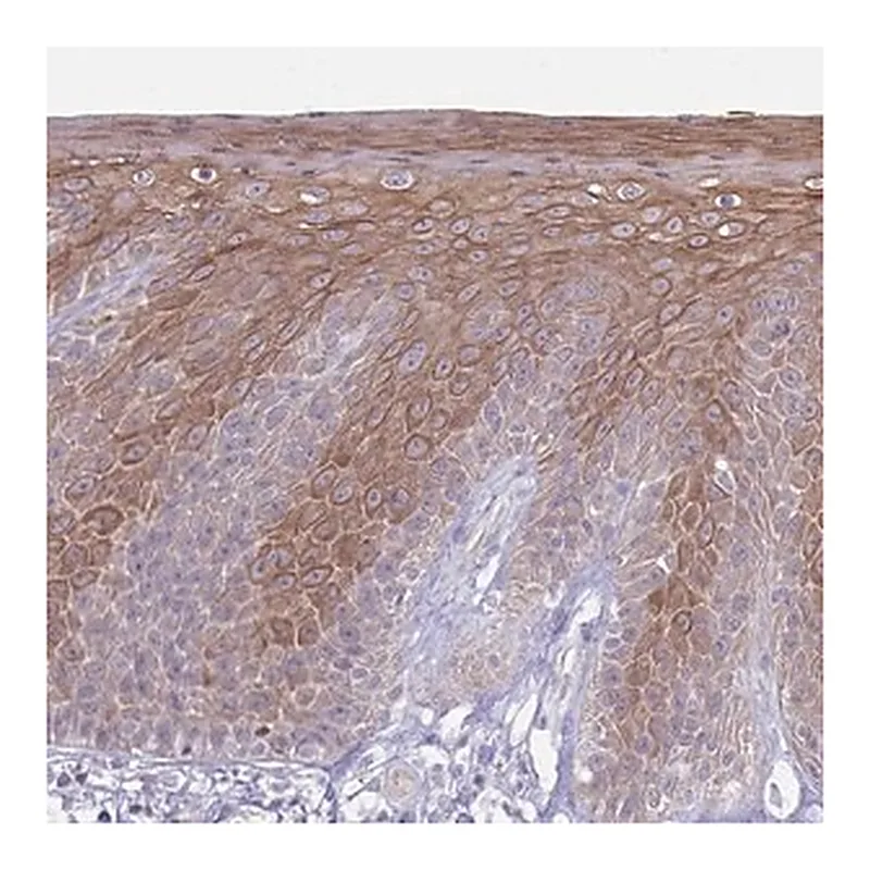 Merck Anti-CDKN2B antibody produced in rabbit