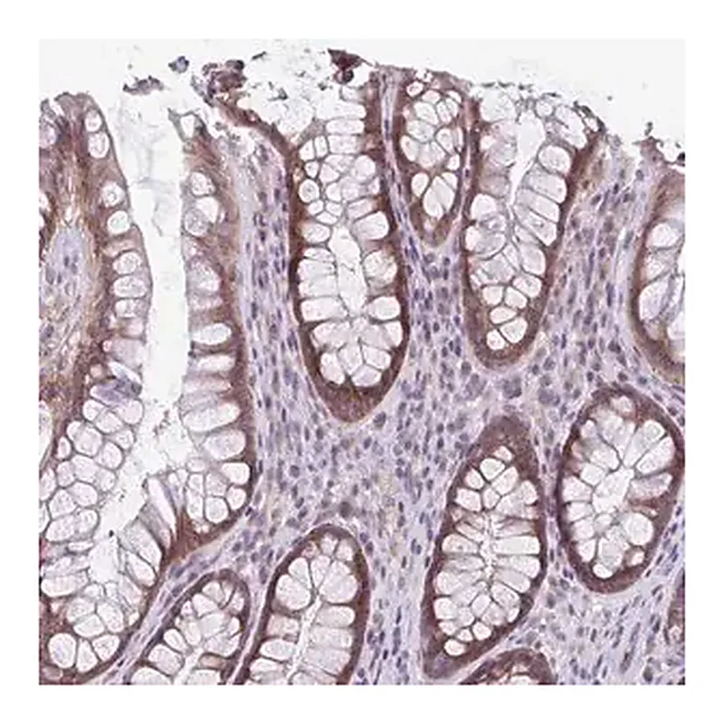 Merck Anti-TMEM108 antibody produced in rabbit