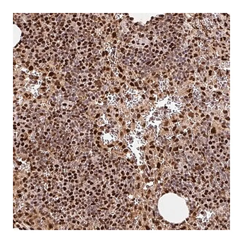 Merck Anti-SET antibody produced in rabbit