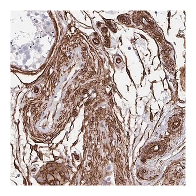 Merck Anti-DCHS2 antibody produced in rabbit
