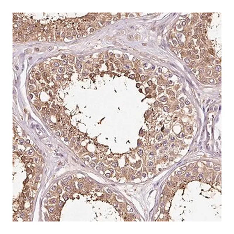 Merck Anti-METAP1 antibody produced in rabbit