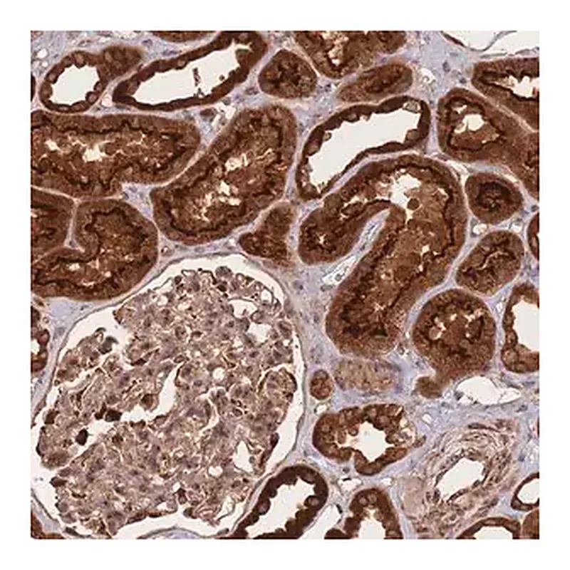 Merck Anti-PRKAR2A antibody produced in rabbit