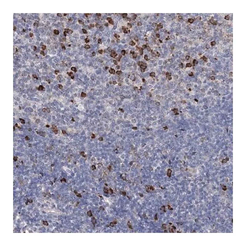 Merck Anti-ANKRD16 antibody produced in rabbit