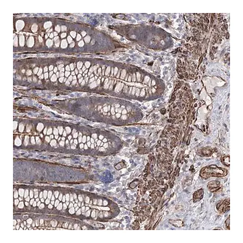 Merck Anti-ARHGAP20 antibody produced in rabbit