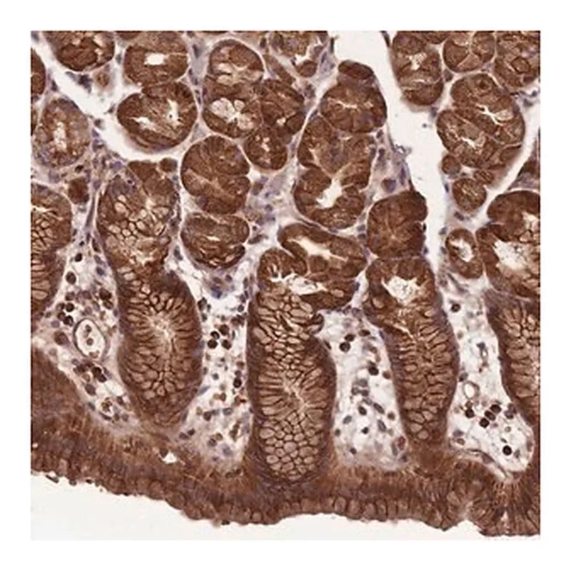Merck Anti-ANKRD10 antibody produced in rabbit