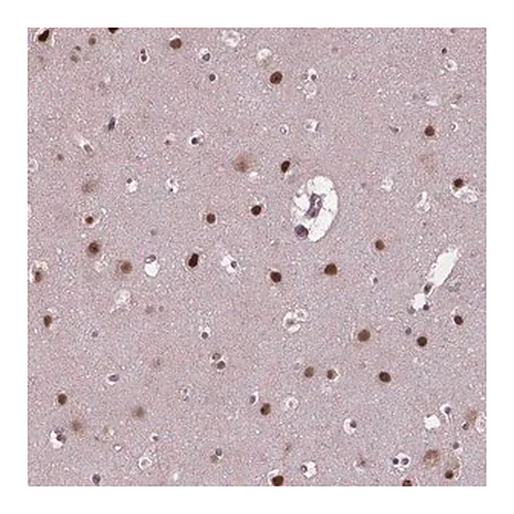 Merck Anti-APTX antibody produced in rabbit