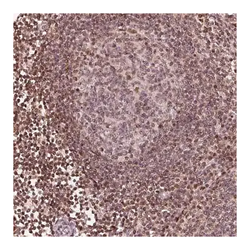 Merck Anti-DDX11 antibody produced in rabbit