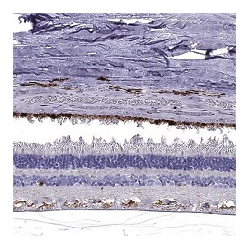 Merck Anti-CLIC6 antibody produced in rabbit