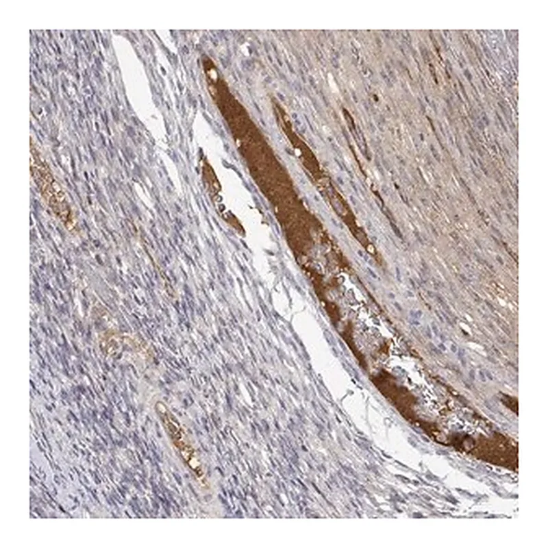 Merck Anti-IGFBP4 antibody produced in rabbit