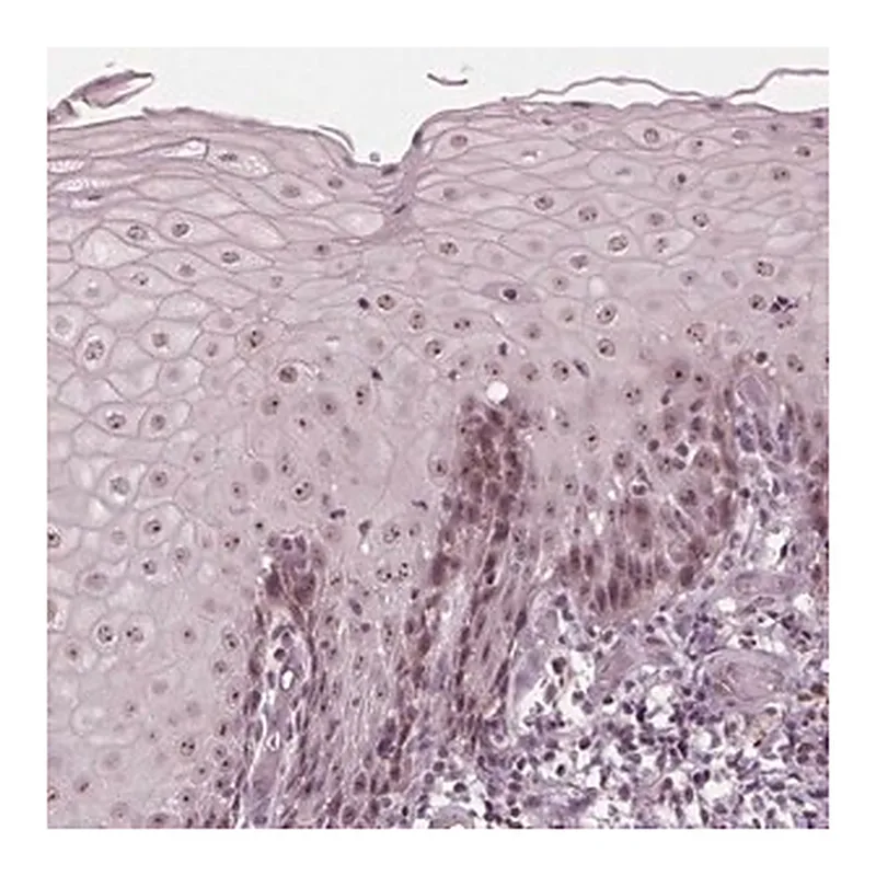 Merck Anti-SLX4 antibody produced in rabbit