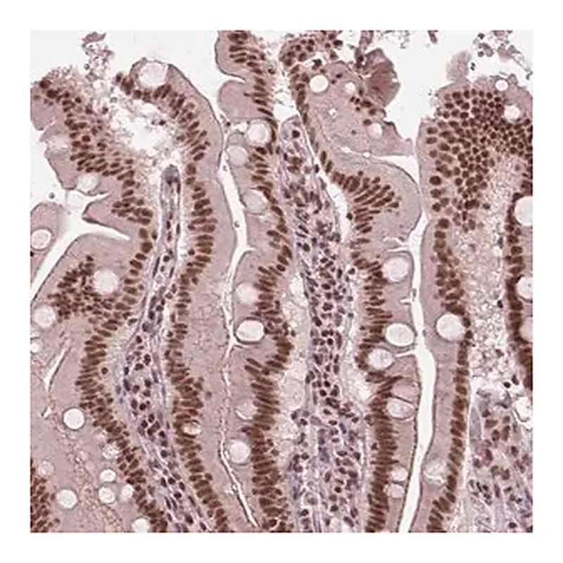 Merck Anti-LSM2 antibody produced in rabbit