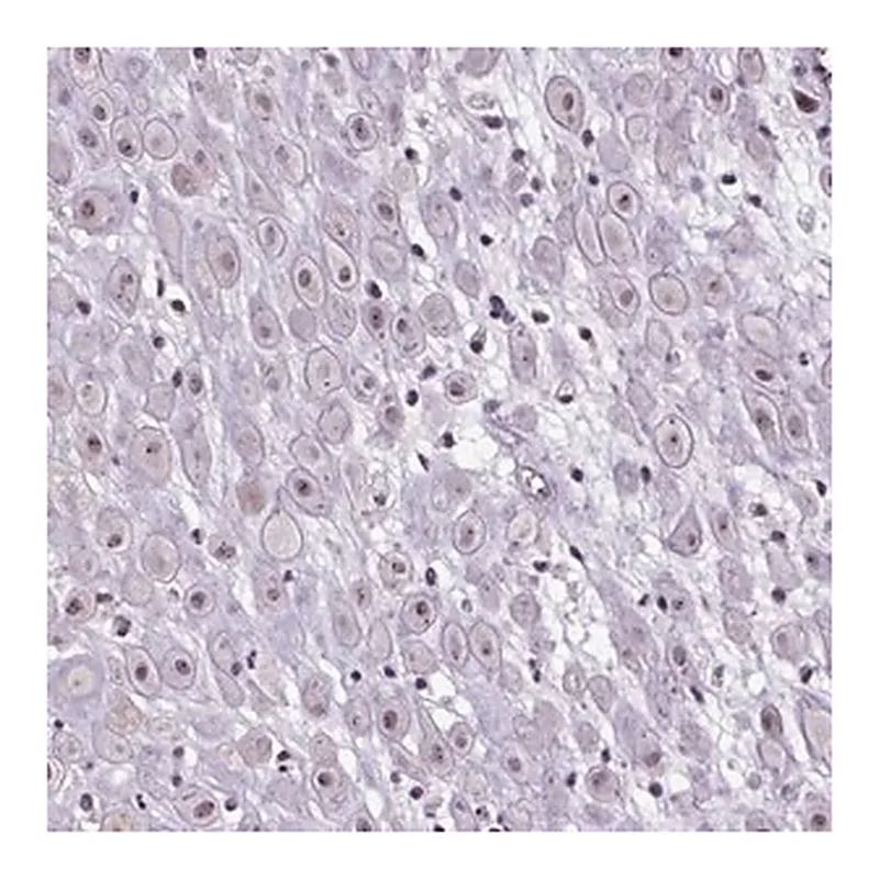 Merck Anti-ATMIN antibody produced in rabbit
