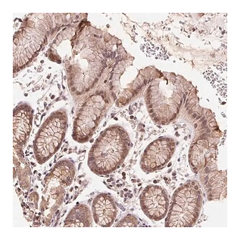 Merck Anti-BTF3L4 antibody produced in rabbit