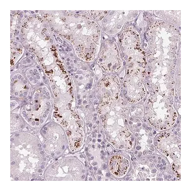 Merck Anti-SAMD5 antibody produced in rabbit