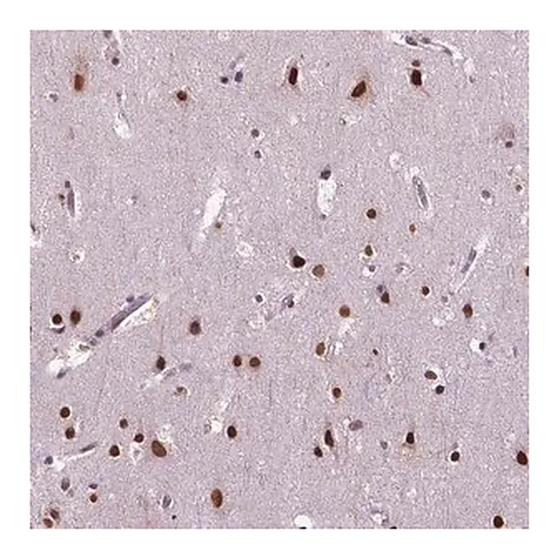 Merck Anti-COL23A1 antibody produced in rabbit