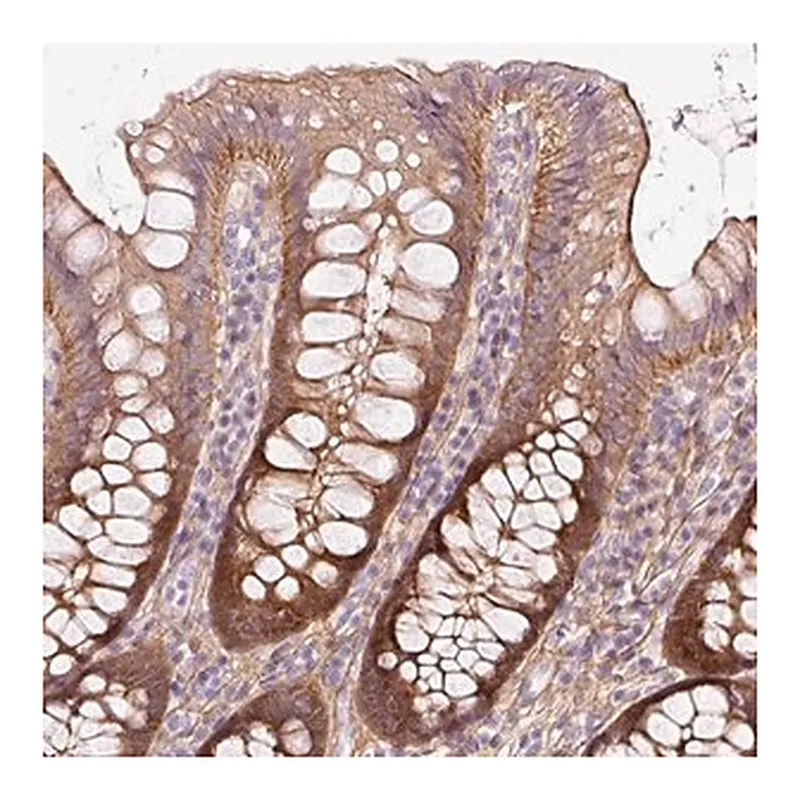 Merck Anti-SOS2 antibody produced in rabbit